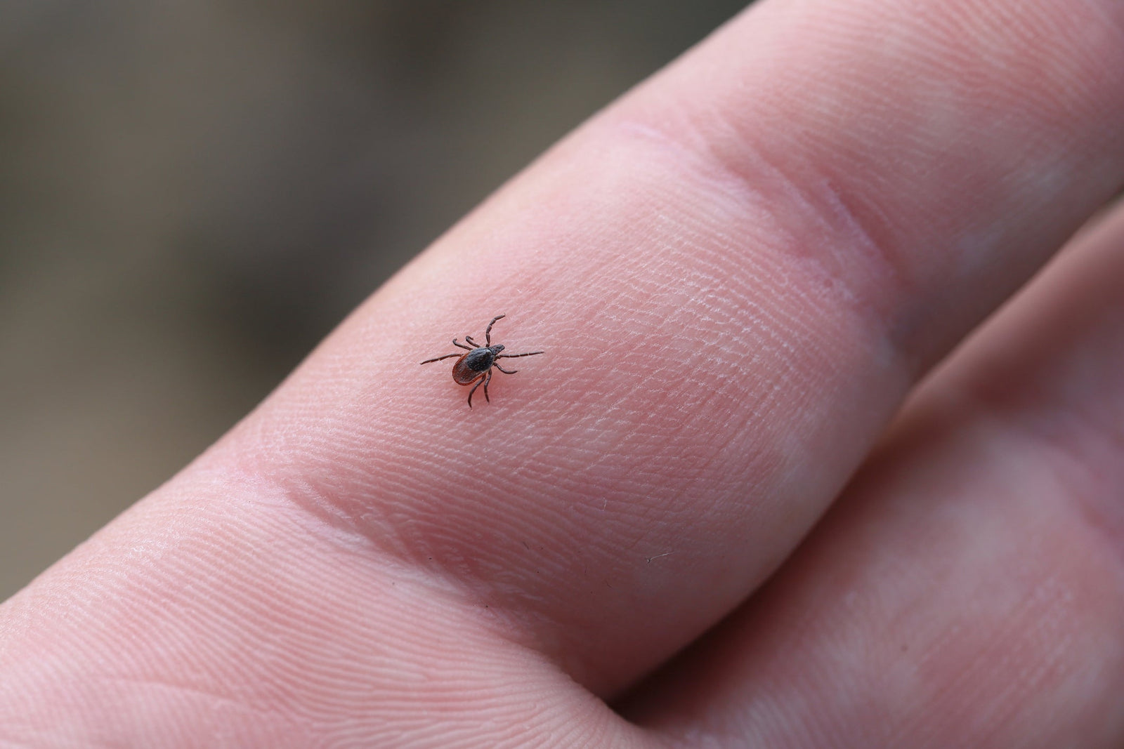 Everything You Need to Know About Tick Bites: Prevention, Identification, Treatment & Disease Protection
