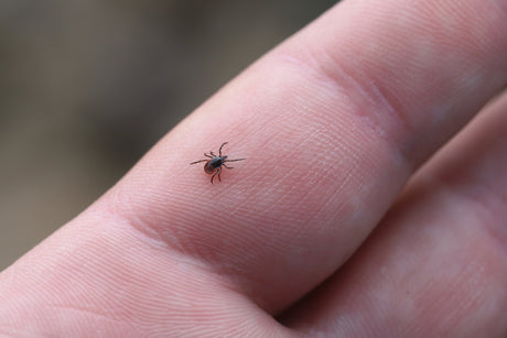 Everything You Need to Know About Tick Bites: Prevention, Identification, Treatment & Disease Protection